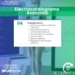 Electrocardiograma avanzado
