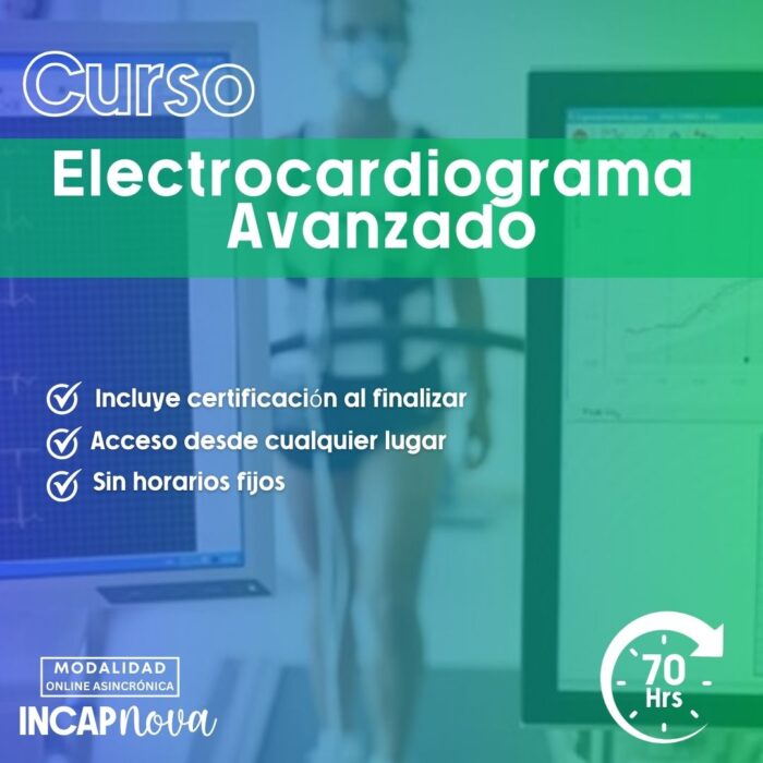 Electrocardiograma avanzado